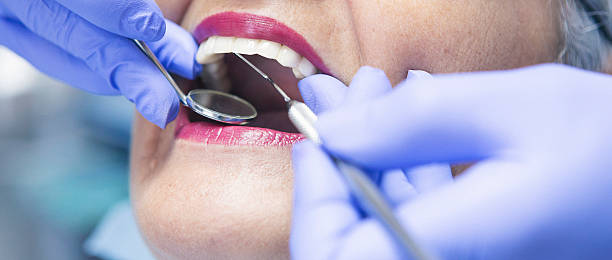 Best Emergency Treatment for Dental Infections or Abscesses in Ridgebury, CT